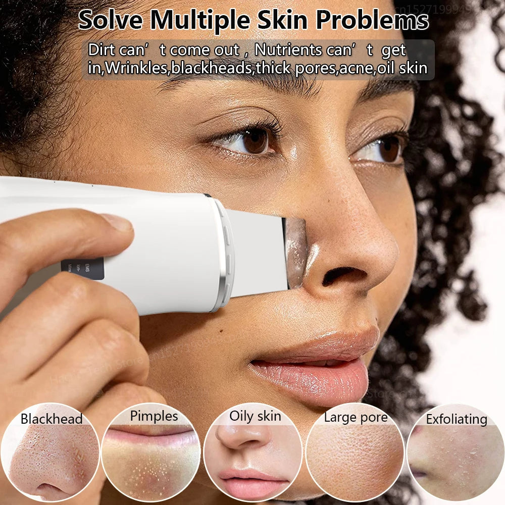 Pure Complexion™ Ultrasonic Skin Scrubber