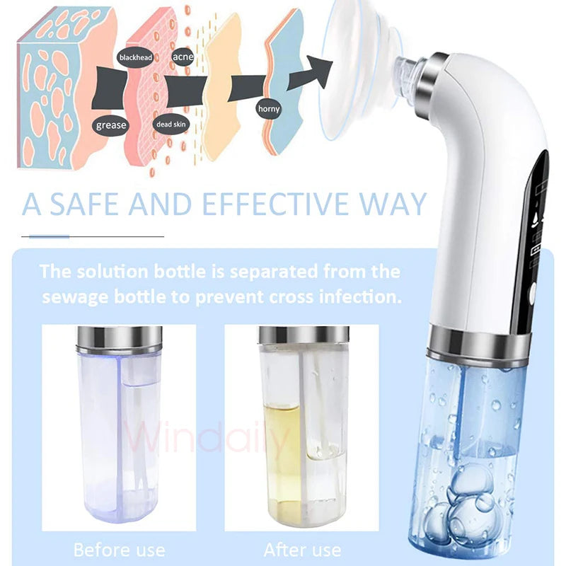 Small Bubble Facial Cleasing Machine