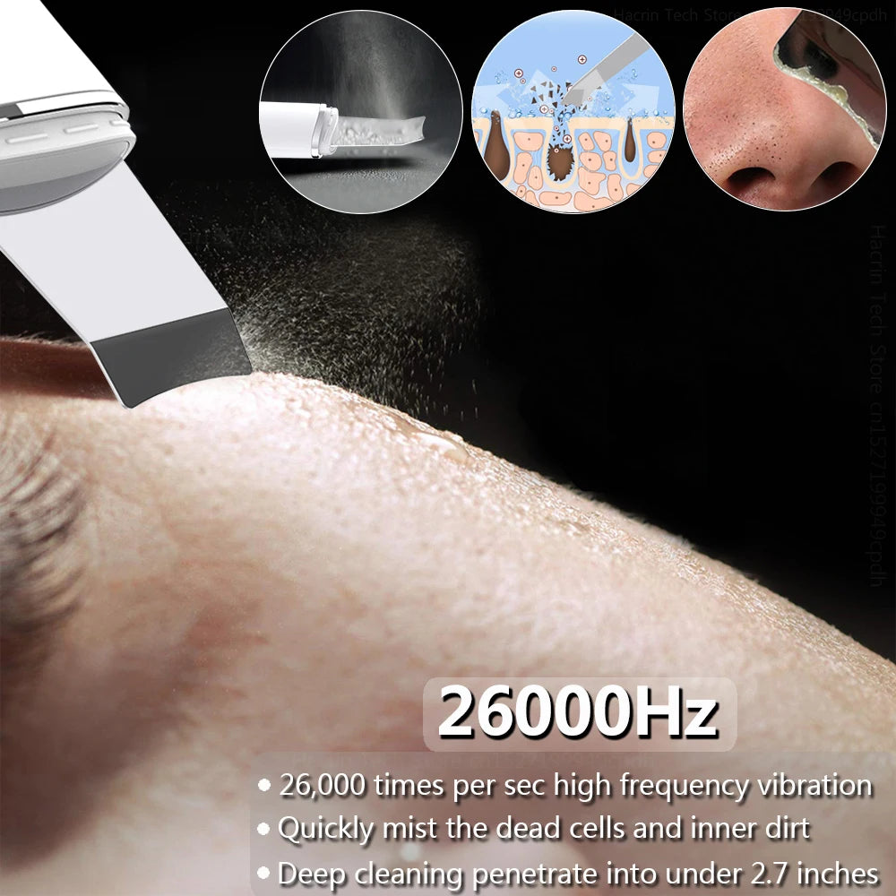 Pure Complexion™ Ultrasonic Skin Scrubber